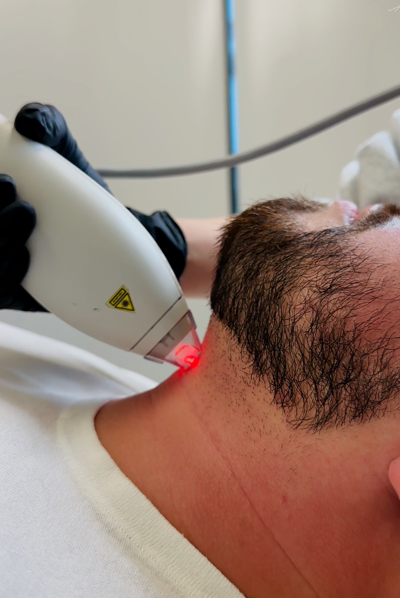 Is Clear + Brilliant® Worth It? FAQs on Results, Costs, and What to Expect